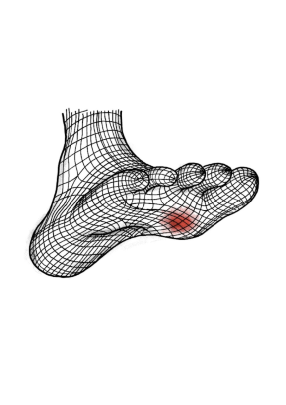 SoleSense image